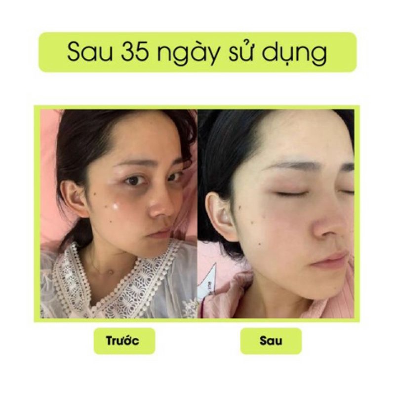 Kem Thâm Mắt Gấu Trúc Peiland 15gram