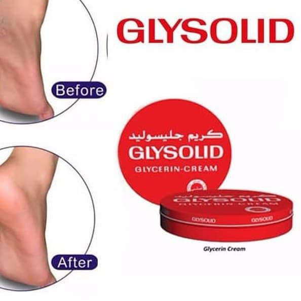 (Hàng Mới Về) Kem Glysolid Glycerin Dung Tích 80ml