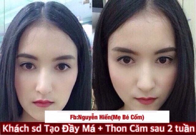 Tinh chất đầy má baby Miracle | BigBuy360 - bigbuy360.vn