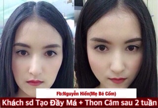 Tinh chất đầy má baby Miracle