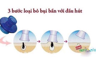 Máy hút mụn cầm tay mini Nhật Bản