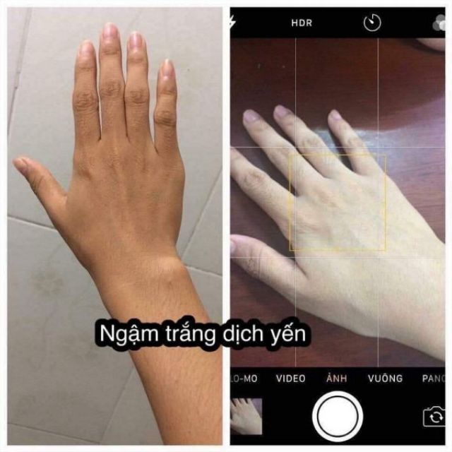 Ngậm trắng dịch yến | BigBuy360 - bigbuy360.vn