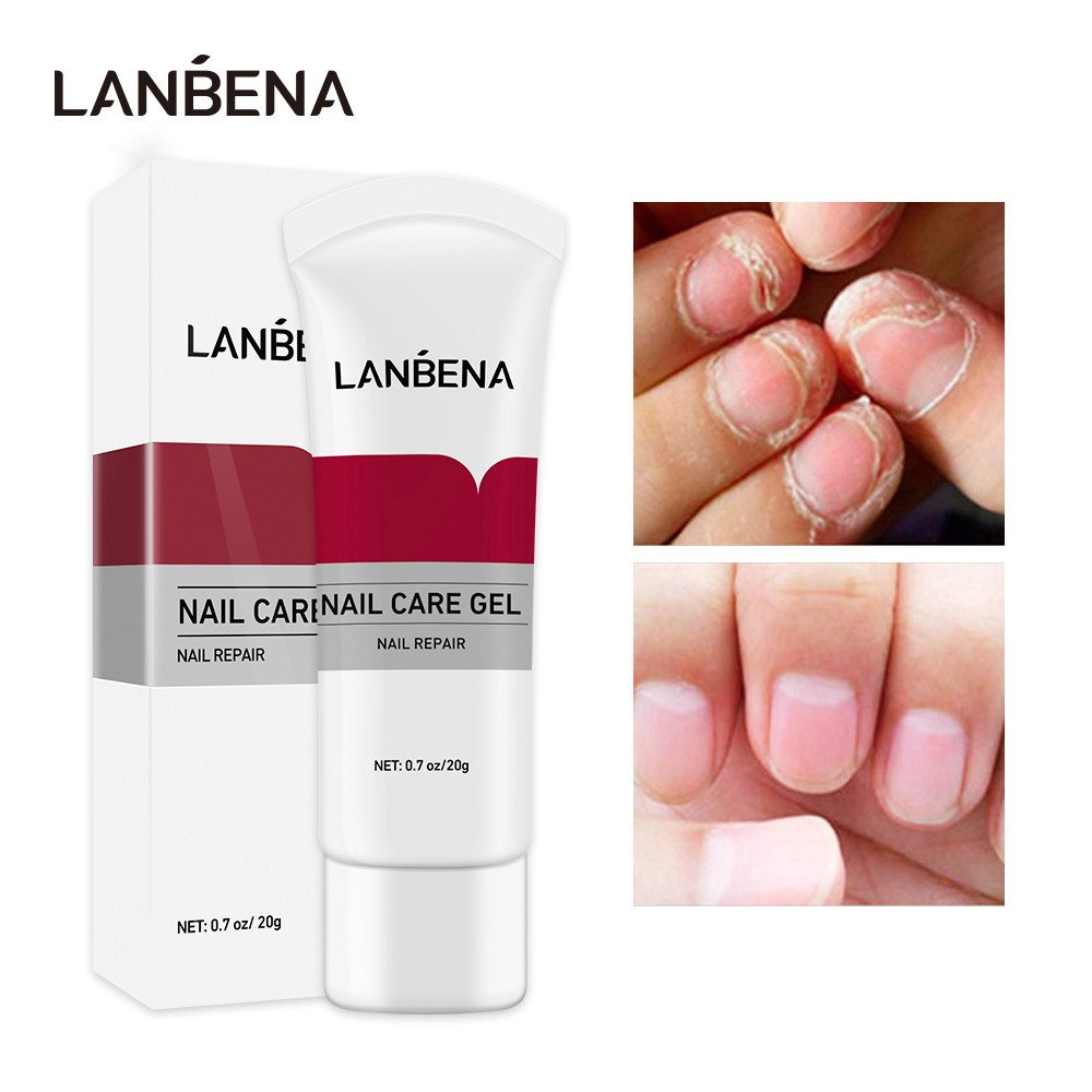 Gel Chăm Sóc Móng LANBENA 20g Phục Hồi Và Loại Bỏ Nấm Móng Chân