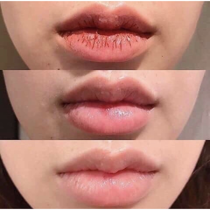 Tẩy Tế Bào Chết Môi Lip Crub ( môi căng mọng mướt mịn). | BigBuy360 - bigbuy360.vn