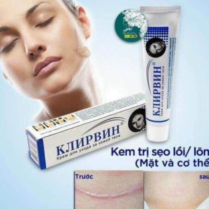 Kem Hỗ Trợ Trị Sẹo Klirvin Chính Hãng Của Nga 5.0