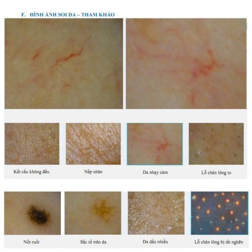 Máy soi da 9 inch có chụp ảnh chính hãng