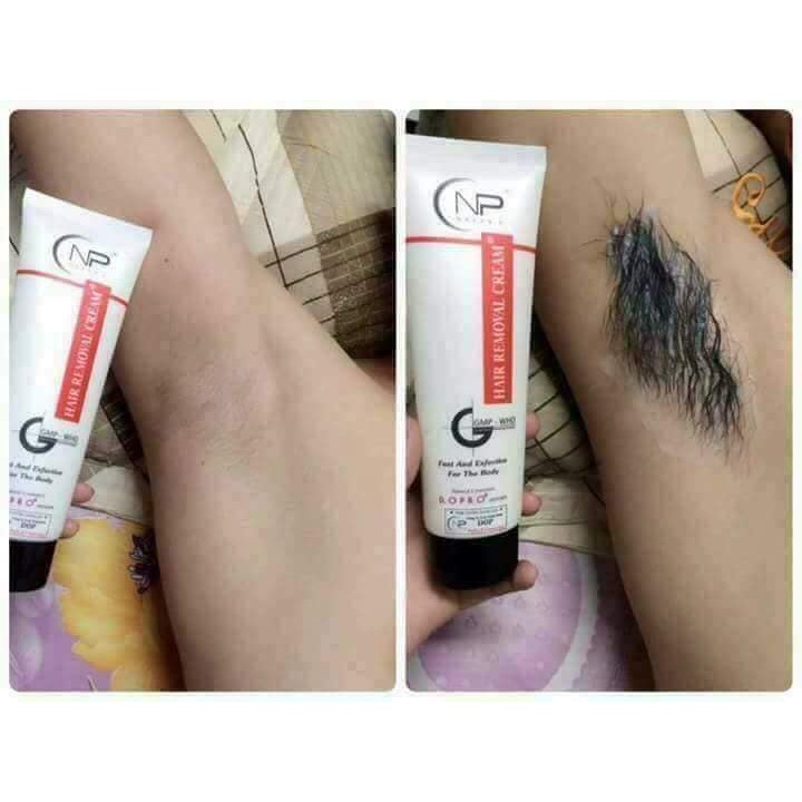 KEM TẨY LÔNG NELLY.P | BigBuy360 - bigbuy360.vn