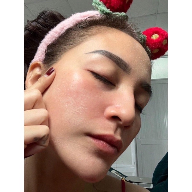 Tinh chất tái tạo da -Không sưng k đỏ chai 20 ml handmade