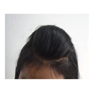 Dụng cụ độn phồng mái