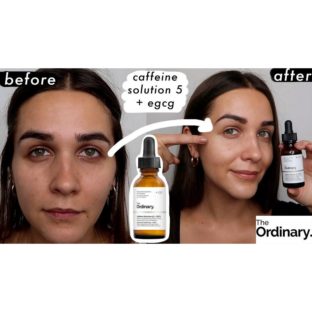 Tinh chất trị quầng thâm mắt The Ordinary Caffeine Solution 5% + EGCG