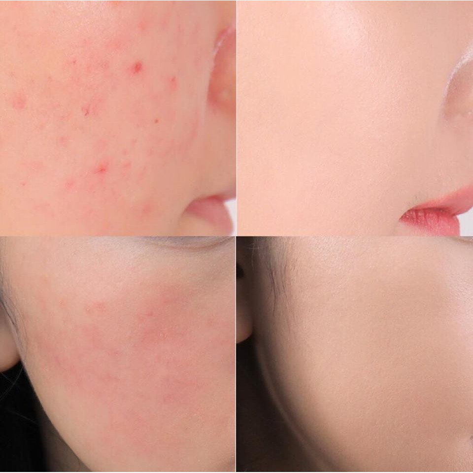 Phấn nước Clio Kill Cover Founwear Cushion Xp 20Ss Limited (15gx2 lõi) Lâu trôi, mịn da - HONGS BEAUTY | BigBuy360 - bigbuy360.vn