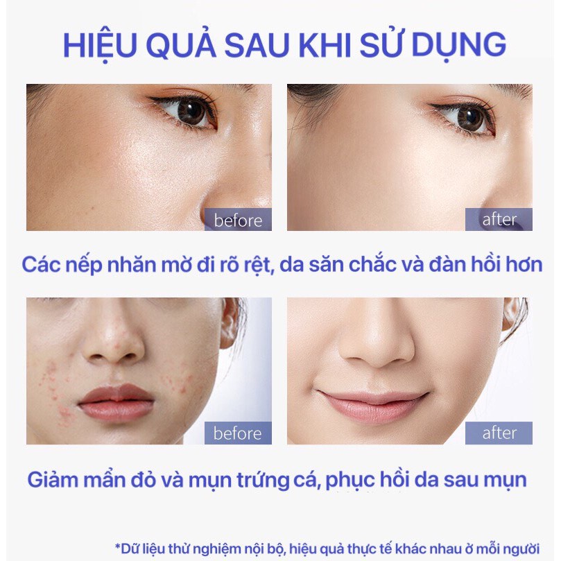 [LUCENBASE] Tinh chất Blue Copper Peptide Essence chống lão hóa dưỡng ẩm giảm viêm phục hồi da căng mịn 30ml