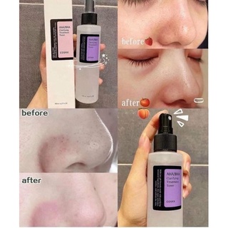 TONER 𝐂𝐎𝐒𝐑𝐗 𝐀𝐇𝐀 /𝐁𝐇𝐀 𝐂𝐋𝐀𝐑𝐈𝐘𝐈𝐍𝐆 𝐓𝐑𝐄𝐀𝐓𝐌𝐄𝐍𝐓 280ml