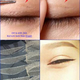 Kích mí lưới thần thánh