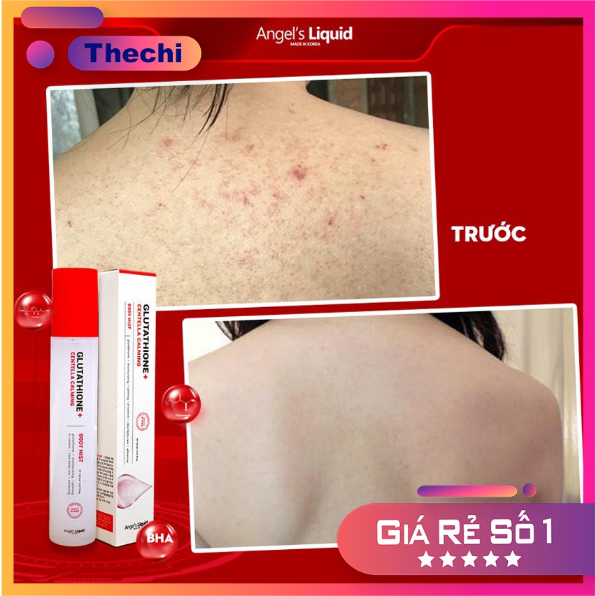 Xịt giảm mụn lưng, dưỡng trắng cơ thể Angel's Liquid Glutathione Plus Centella Calming Body Mist 150ml | BigBuy360 - bigbuy360.vn