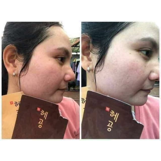 Ủ trắng căng bóng da mặt
