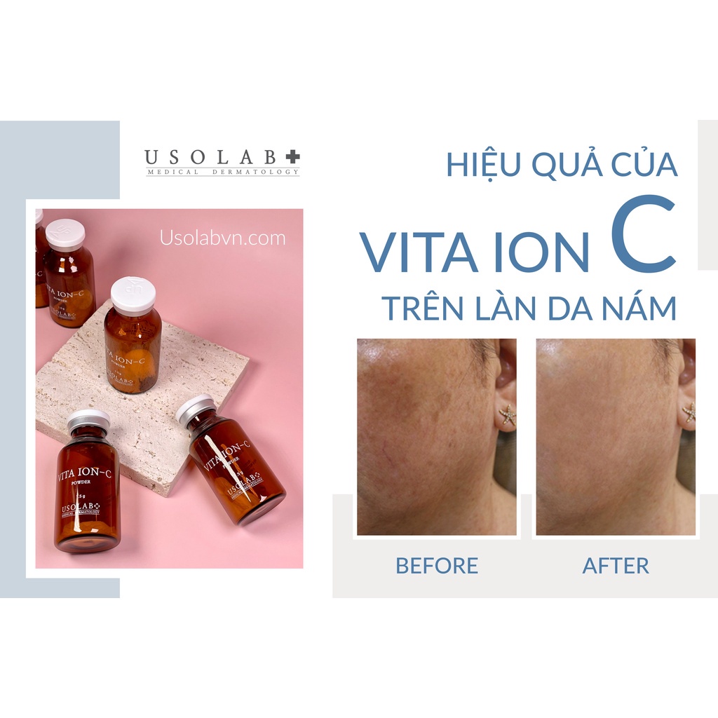 Điện di trắng da, mờ nám tại nhà Vita Ion C Usolab Korea | BigBuy360 - bigbuy360.vn