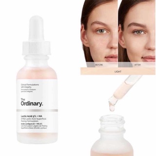 Tinh chất tẩy tế bào chết - cấp nước the ordinary serum - latic acid 5%+ ha 2% / latic acid 10%+ ha 2%