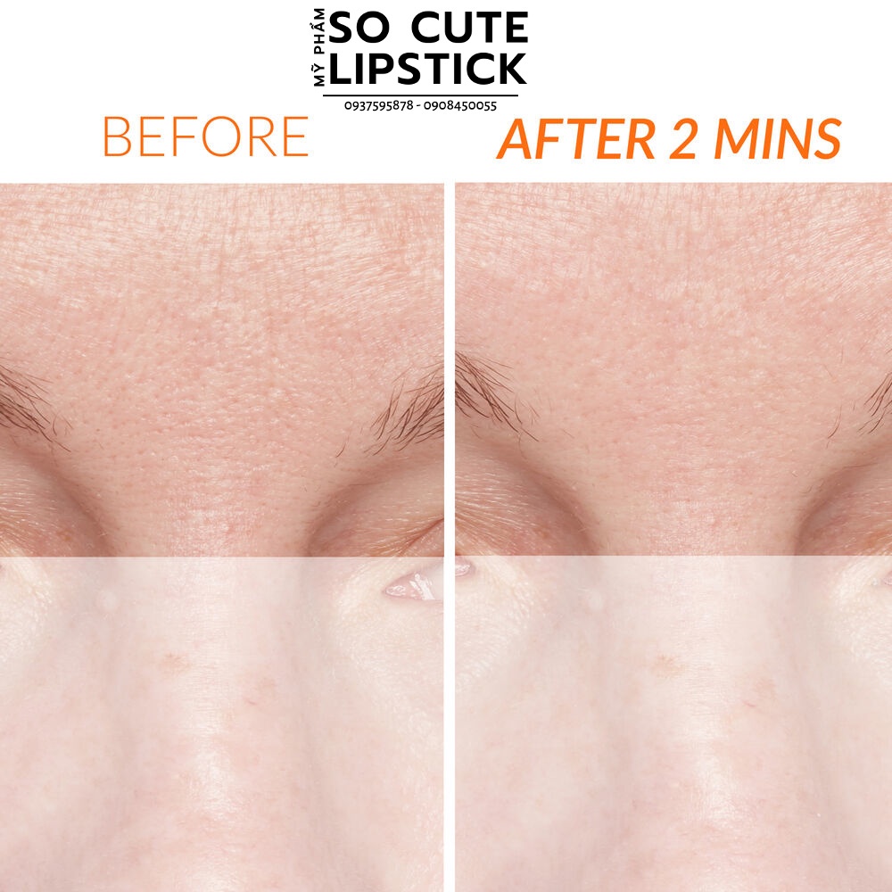 Mini 7.5ml - Tẩy tế bào chết nổi tiếng Kate Somerville ExfoliKate Intensive Exfoliating Treatment