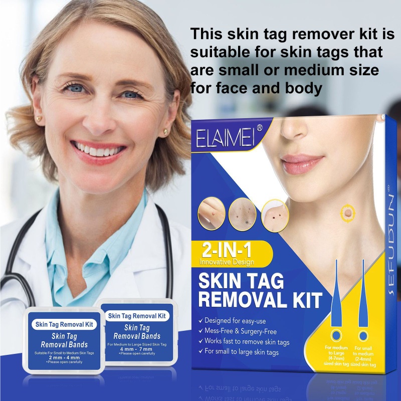 Thiết Bị Loại Bỏ Mụn Thịt Dư Trên Da Tiện Dụng