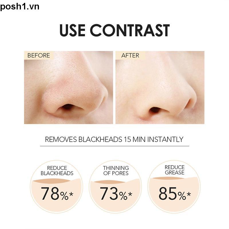 Mặt Nạ Lột Mụn Đầu Đen Làm Sạch Sâu Lỗ Chân Lông O.TWO.O 1.vn