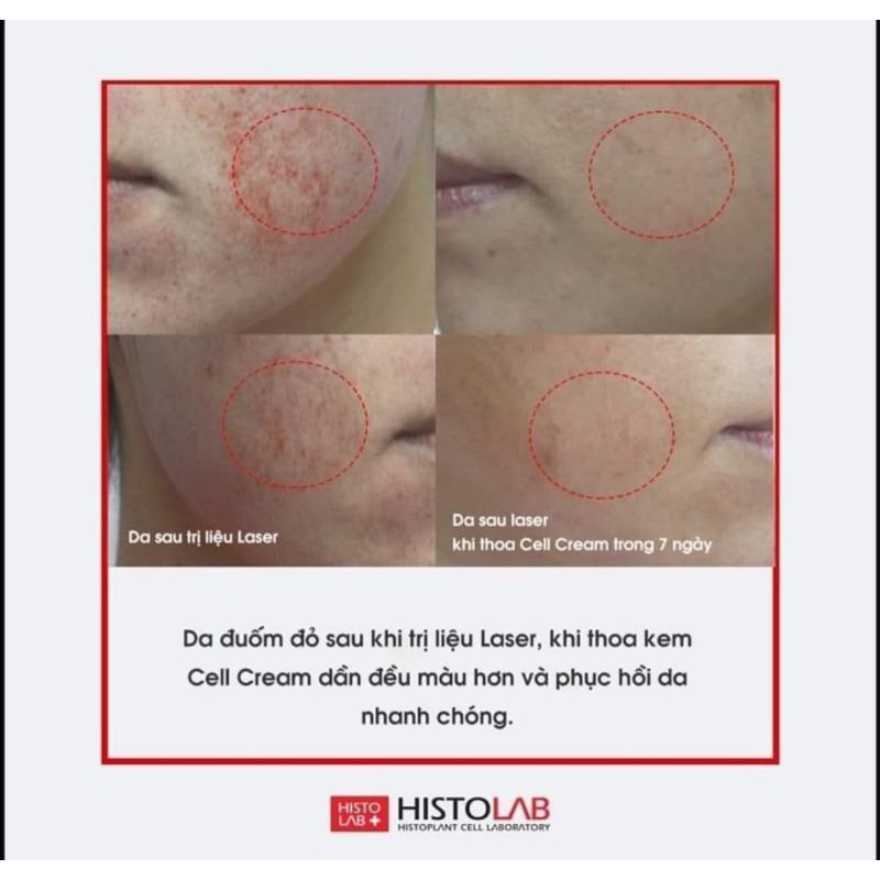 Kem phục hồi dưỡng ẩm tái tạo da cell cream histolab