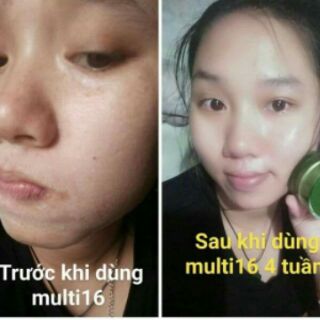 KEM TRỊ RẠN MULTI16