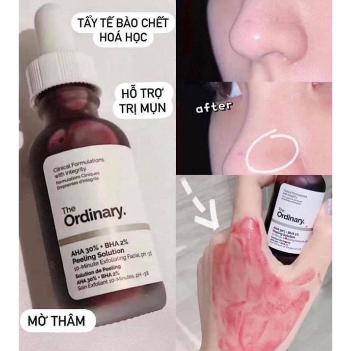 TẨY DA CHẾT HOÁ HỌC + THANH TẨY DA The Ordinary AHA 30% & BHA 2% Peeling Solution