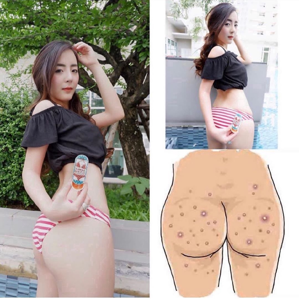 [Hàng mới về] Kem xua tan sắc tố Topping Balm Plus làm sáng trắng da vùng nách khuỷu tay bikini