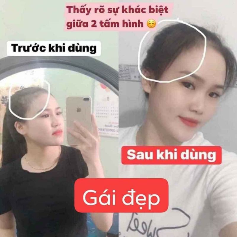 Combo thần sầu siêu rẻ Dầu Gội Thảo Dược Thiên nhiên - Tinh Chất Thảo Mộc - Xịt Bưởi khuyến mãi theo bộ