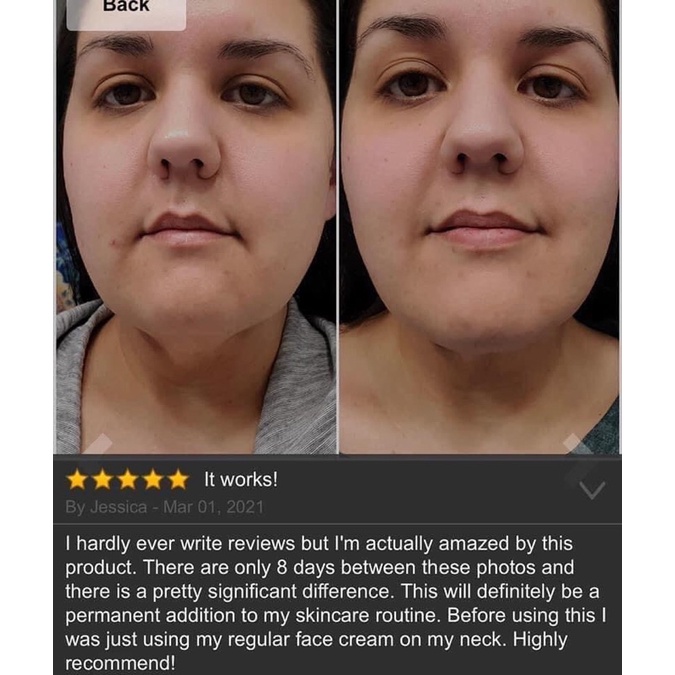 Kem dưỡng săn da cổ, vùng dưới cổ Gold Bond fullsize 56g