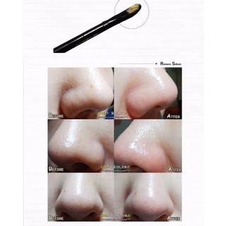 👃 Miếng Dán Hút Mụn Đầu Đen Ciracle 🌪 Good-bye Blackhead