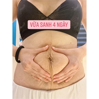[ CHÍNH HÃNG 100%] Kem Tan Mỡ Hana Belly Slim