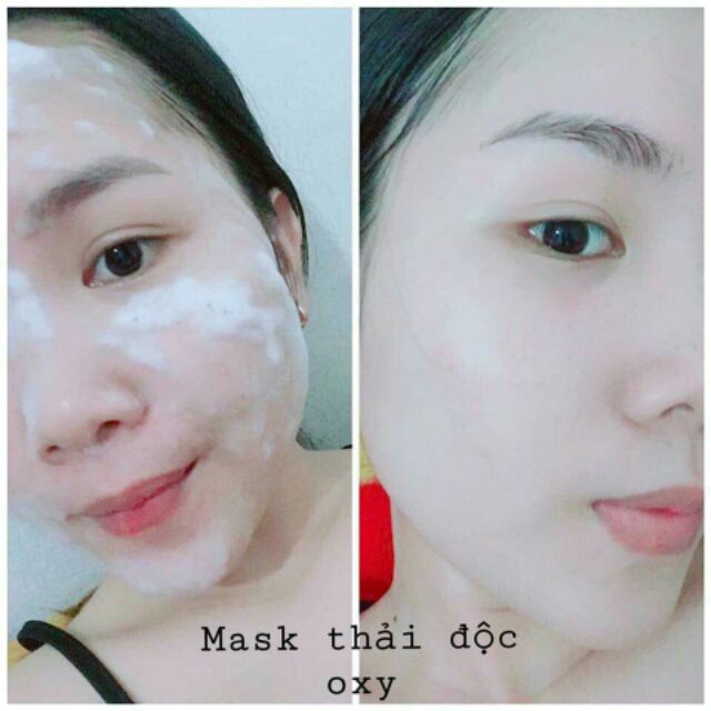 Mặt nạ sủi bọt Oxy tươi - Oxygen bubble detox mask