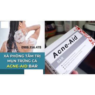Xà phòng Acne Aid Bar. Dùng an toàn, hiệu quả cho da dầu, nhờn và mụn trứng cá, giúp làm sạch da hữu ích và êm dịu,