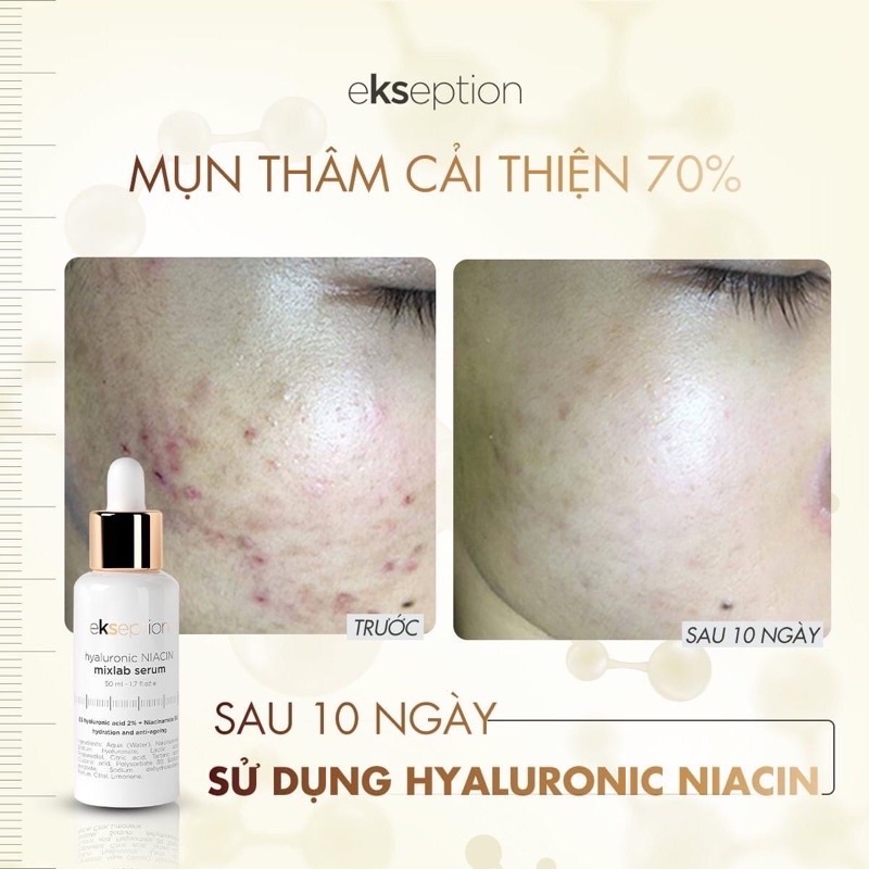 Serum giảm mụn, xóa thâm Ekseption Hyaluronic Niacin