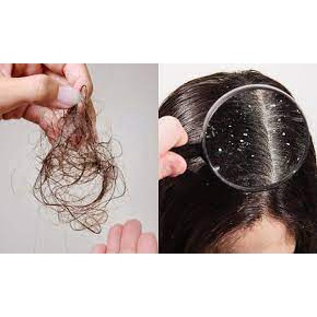 ALLME - Dầu gội RAUSCH cho tóc gàu 40ml