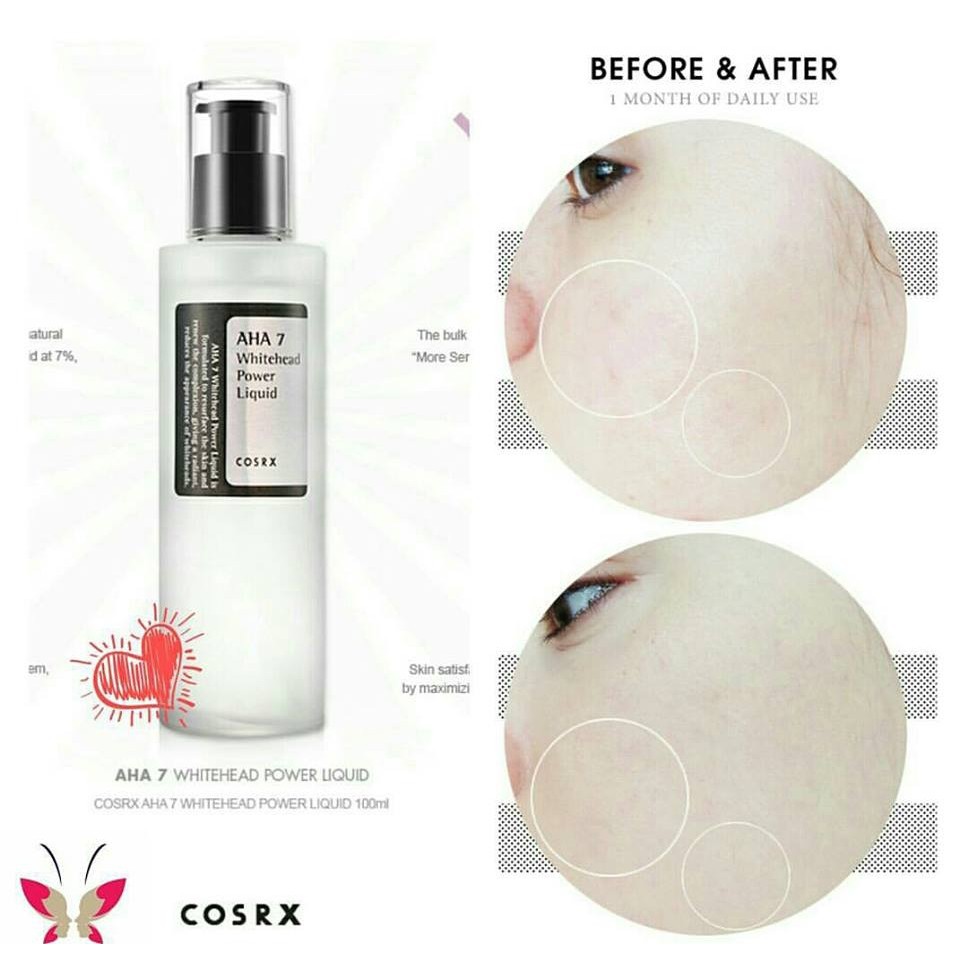 [DATE 6/2023] Dung Dịch Tẩy Da Chết Hóa Học Cho Mụn Cám COSRX AHA 7 Whitehead Power Liquid | BigBuy360 - bigbuy360.vn