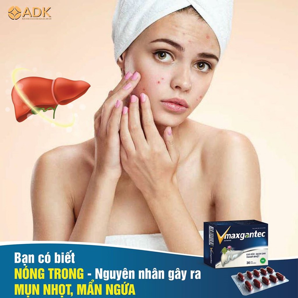 Vmaxgantec - Hỗ trợ giảm mụn do nóng trong người - Hộp 30 viên | BigBuy360 - bigbuy360.vn