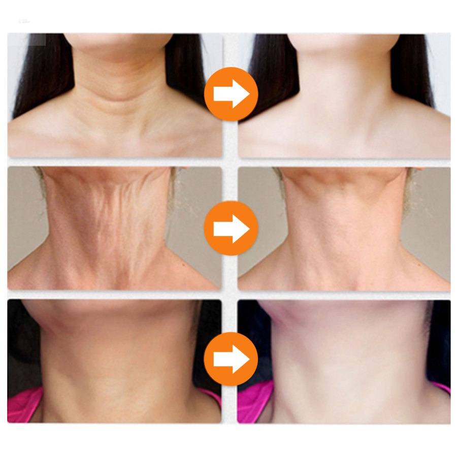 Kem Dưỡng Da Cổ Chứa Collagen Làm Săn Chắc Da Loại Bỏ Quầng Thâm Chống Lão Hóa Dưỡng Ẩm