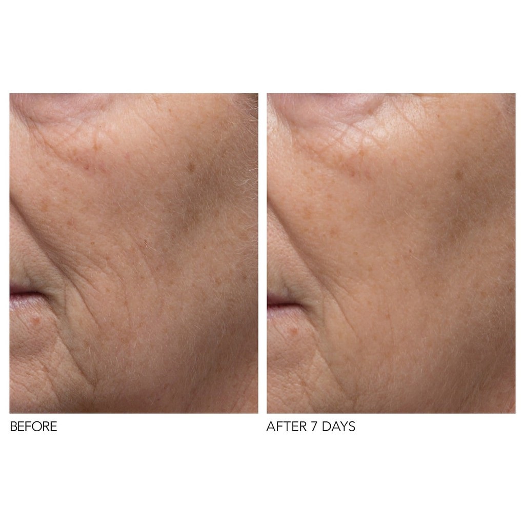 Kem Dưỡng Ẩm Se Khít Lỗ Chân Lông Dr Dennis Gross Pore Perfecting Moisturizer 7ml | BigBuy360 - bigbuy360.vn