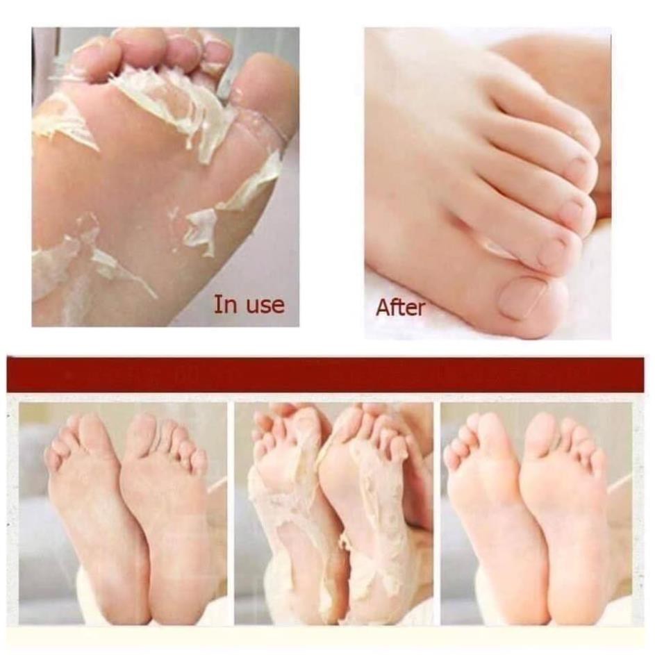 Túi ủ chân TẨY TẾ BÀO CHẾT Lavender Foot Care Pack To Plan Nhật Bản