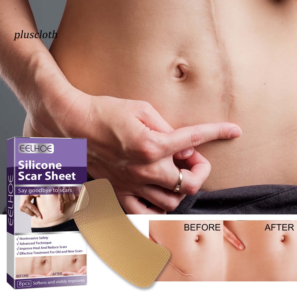 Miếng Dán Hỗ trợ giảm sẹo Siêu Mỏng Chất Lượng Cao