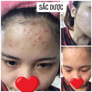 TINH CHẤT TÁI TẠO SẮC DƯỢC