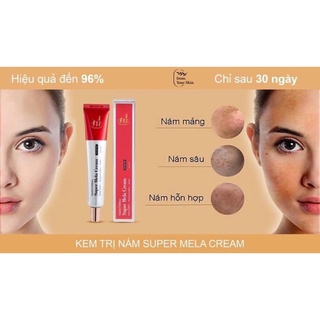 Kem xoá thâm nám, tàn nhang super mela cream
