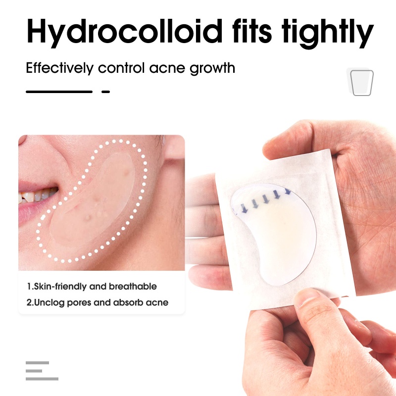 Bộ 20 Miếng Dán Hỗ Trợ Giảm Mụn Hấp Thụ Hydrocolloid Zit S