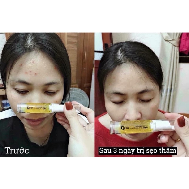 Bút nghệ nano Quin