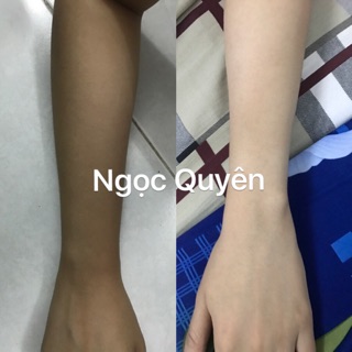 Tắm Trắng Tinh Chất Táo và Kem Body