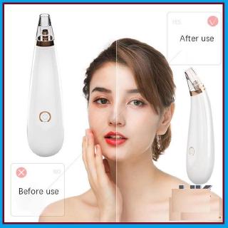 Máy hút mụn đầu đen 3 đầu BLACK HEAD DETECTOR