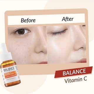 Serum sáng da, mờ thâm Balance Active Formula Vitamin C 30ml